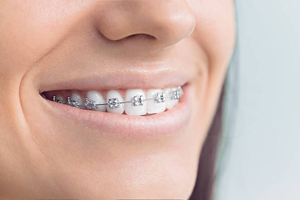 Best Invisalign and Clear Aligners  in Kitty Hawk, NC